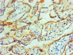 Immunohistochemical of paraffin-embedded Human placenta tissue using CSB-MA0234621A0m at dilution of 1:200.