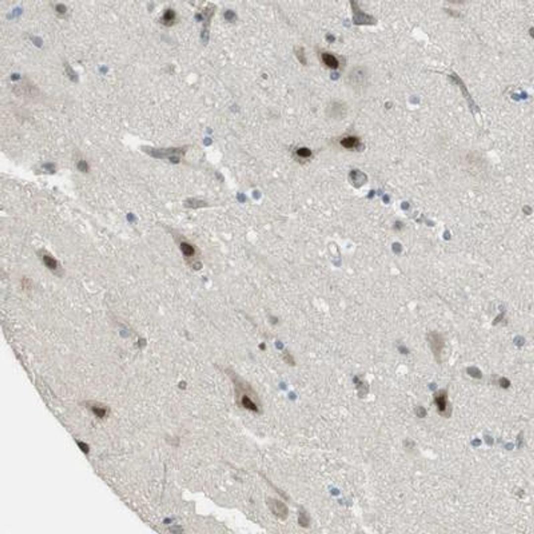 Immunohistochemistry-Paraffin: IGFBP-3 Antibody [NBP1-88374] - Staining of human cerebral cortex shows strong nuclear positivity in neuronal cells.