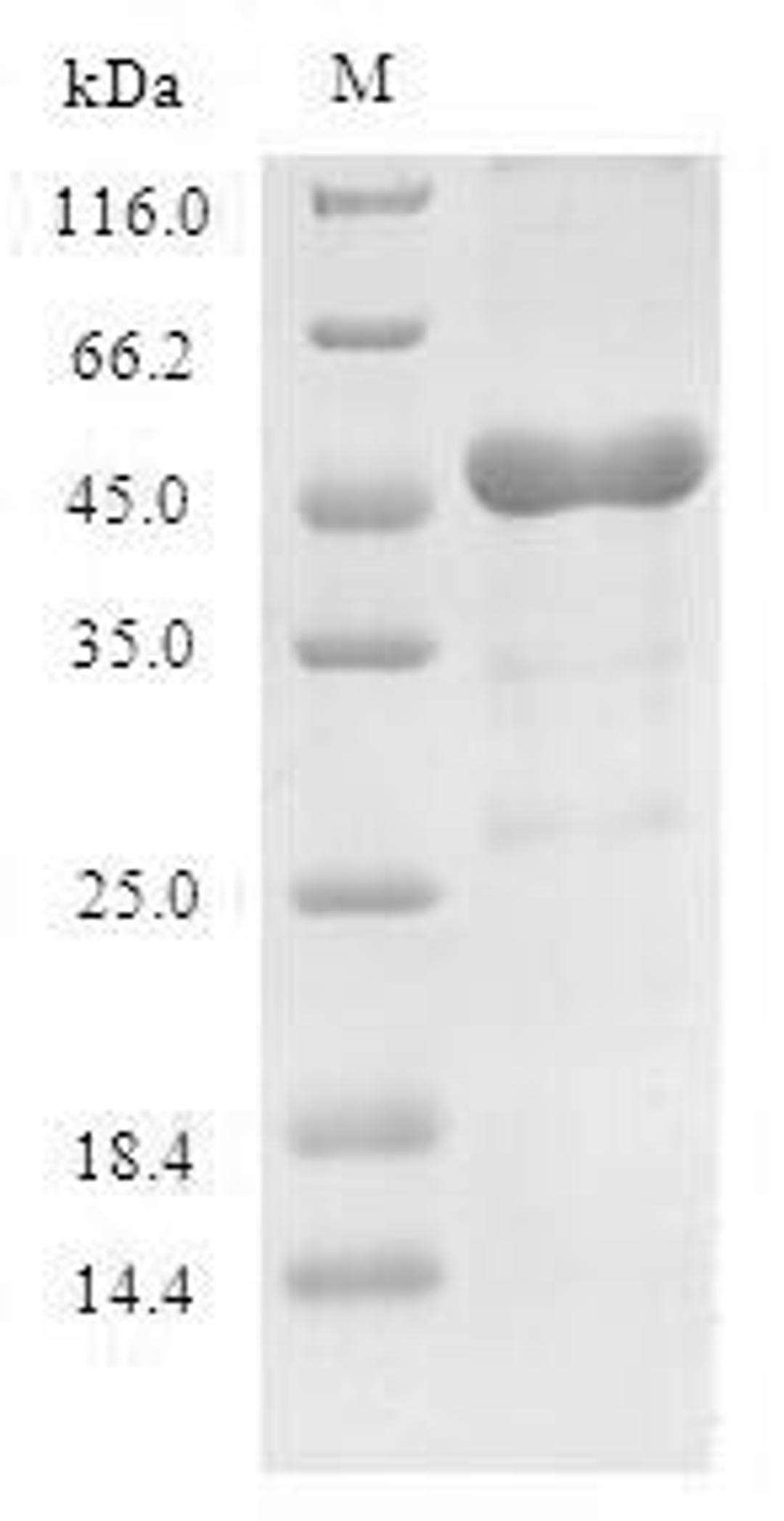 (Tris-Glycine gel) Discontinuous SDS-PAGE (reduced) with 5% enrichment gel and 15% separation gel.