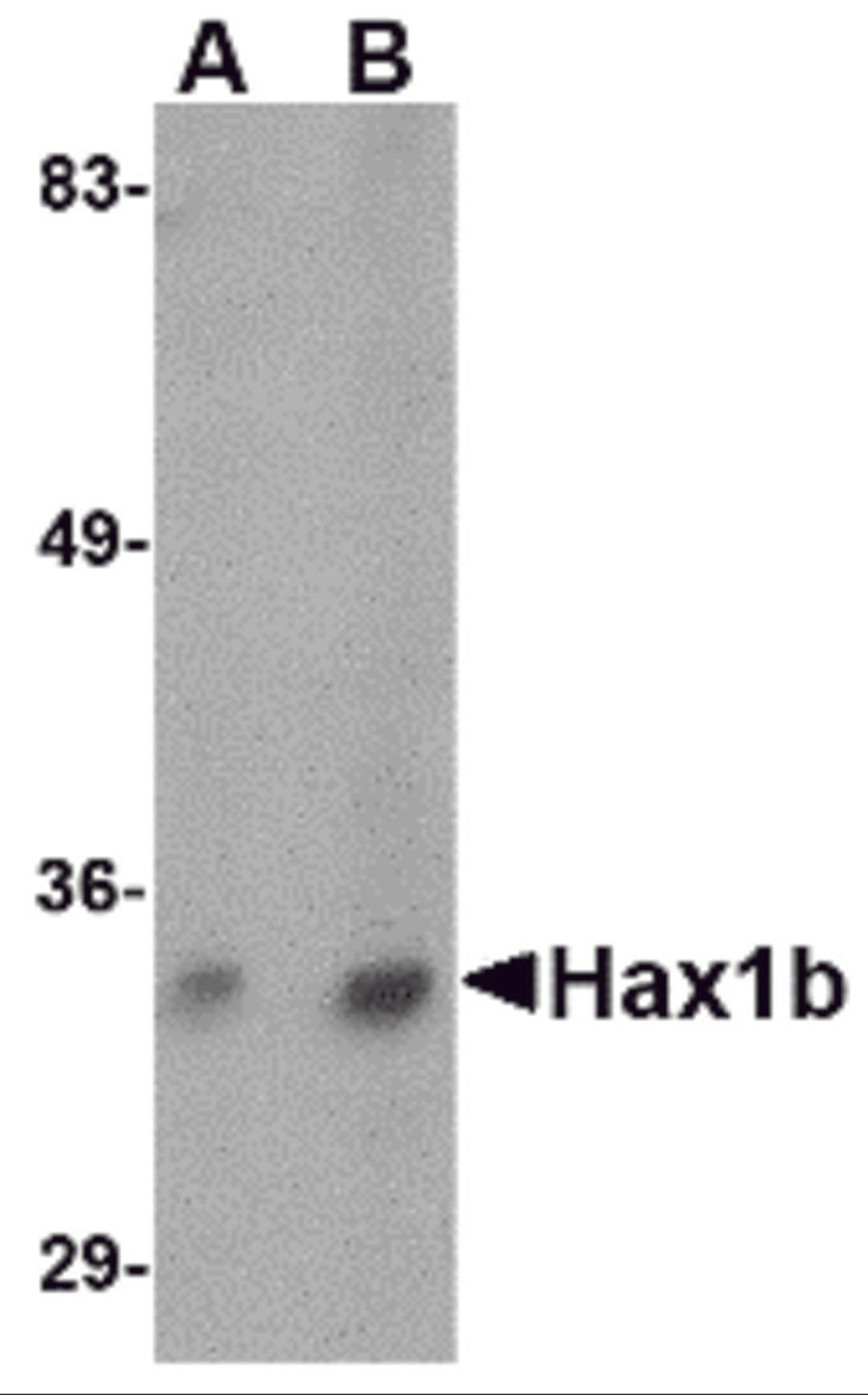 Western blot analysis of Hax1b in mouse brain tissue lysate with Hax1b antibody at (A) 1 and (B) 2 &#956;g/mL.