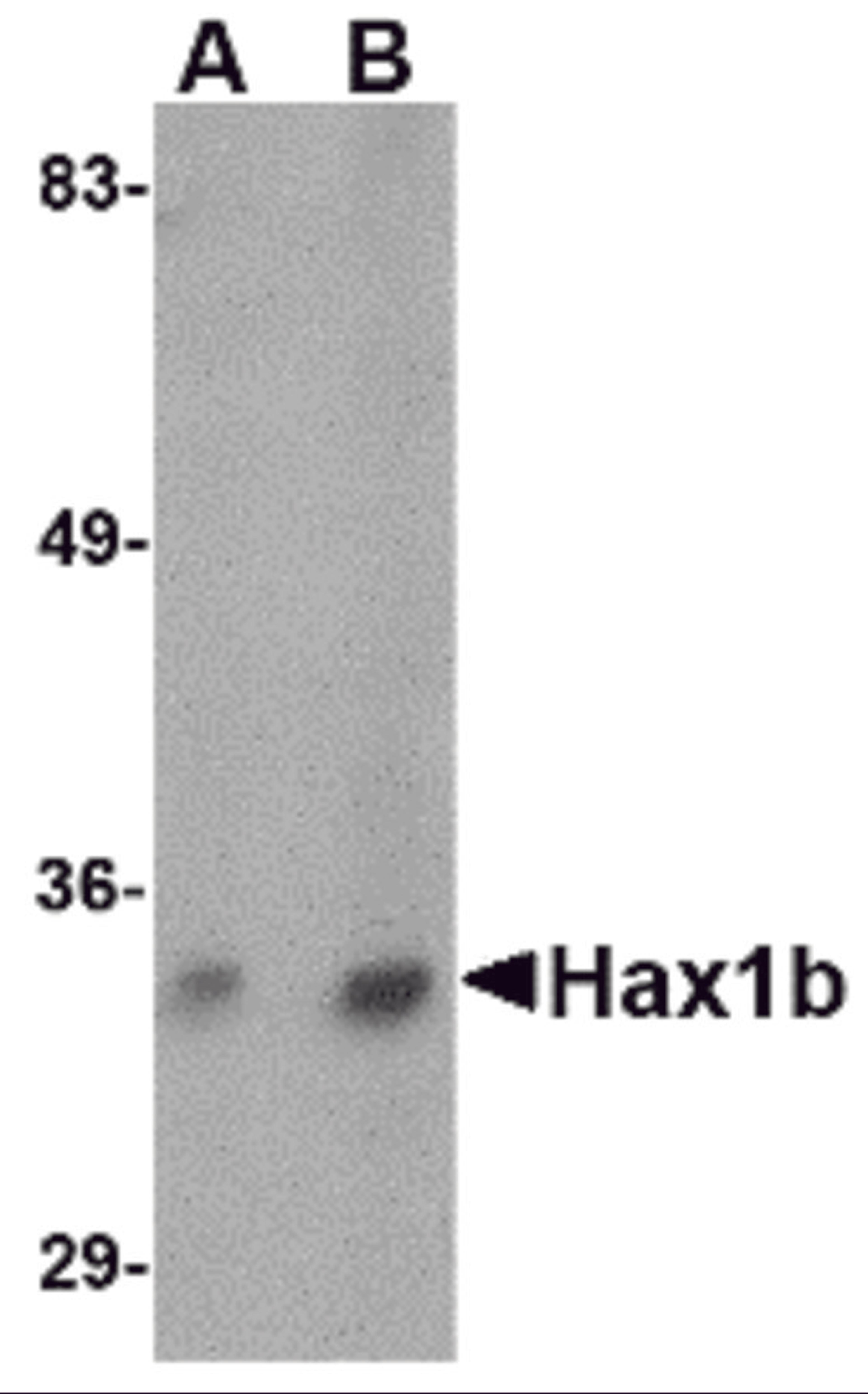 Western blot analysis of Hax1b in mouse brain tissue lysate with Hax1b antibody at (A) 1 and (B) 2 &#956;g/mL.