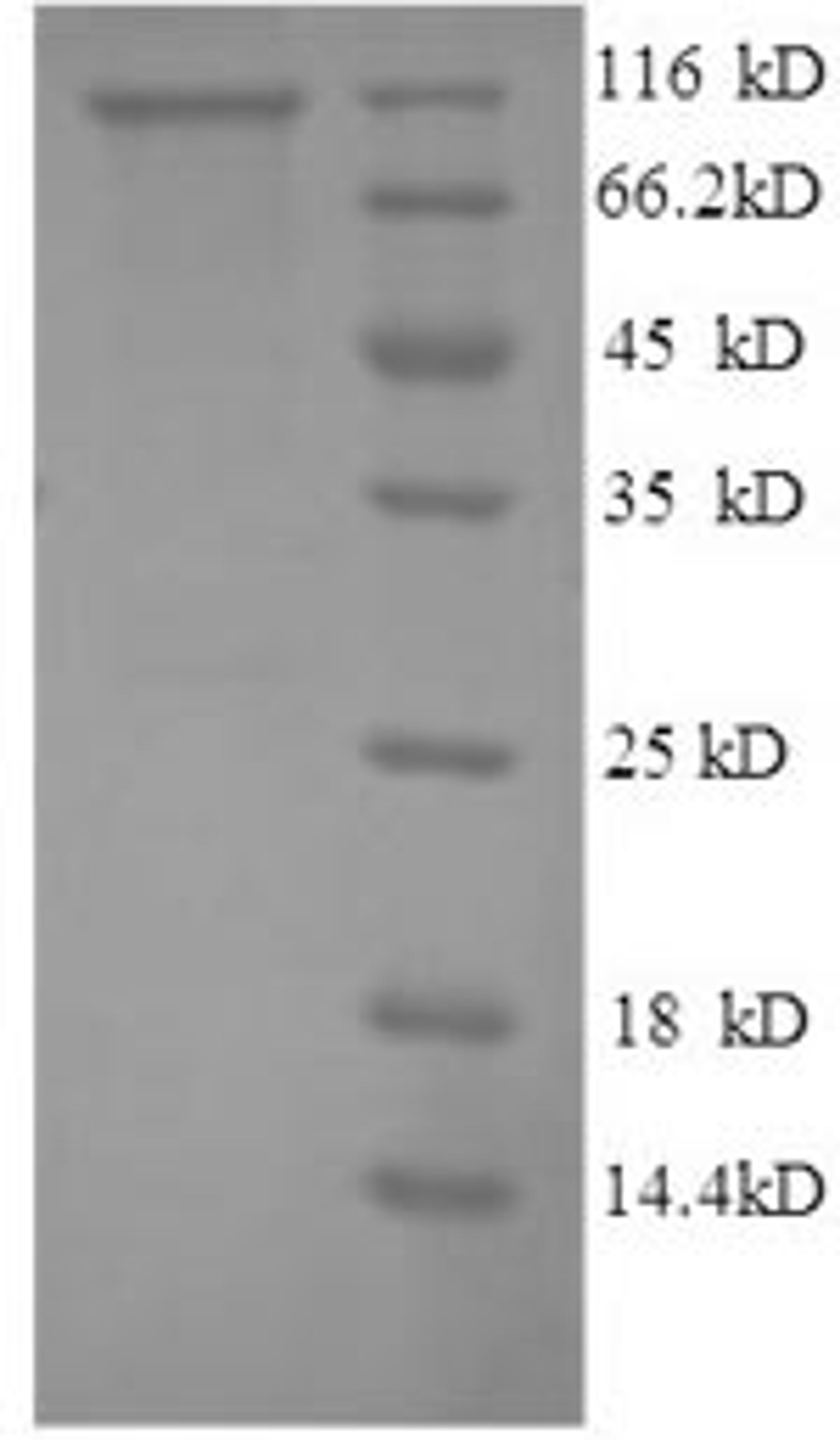 (Tris-Glycine gel) Discontinuous SDS-PAGE (reduced) with 5% enrichment gel and 15% separation gel.