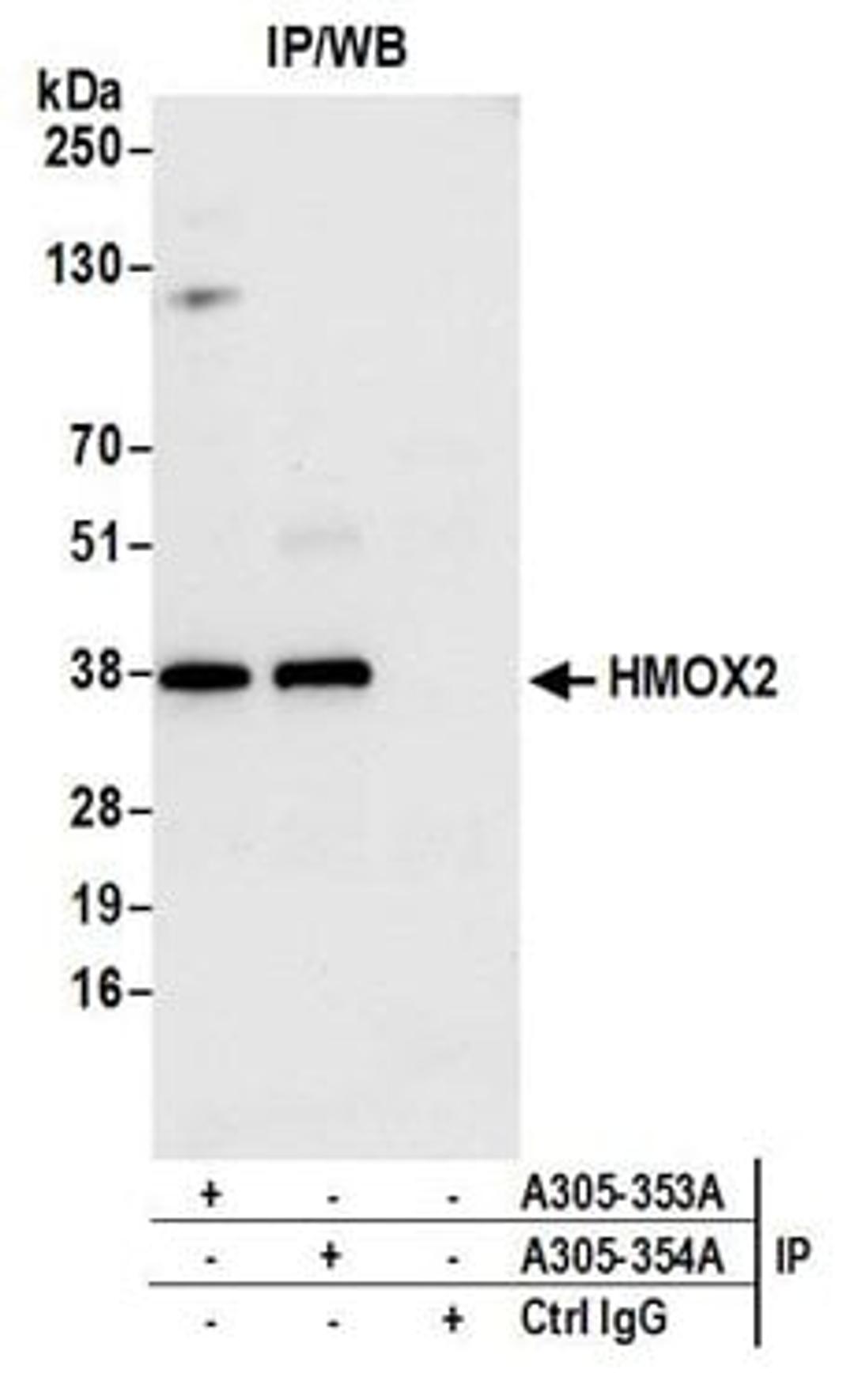 Detection of human HMOX2 by western blot of immunoprecipitates.