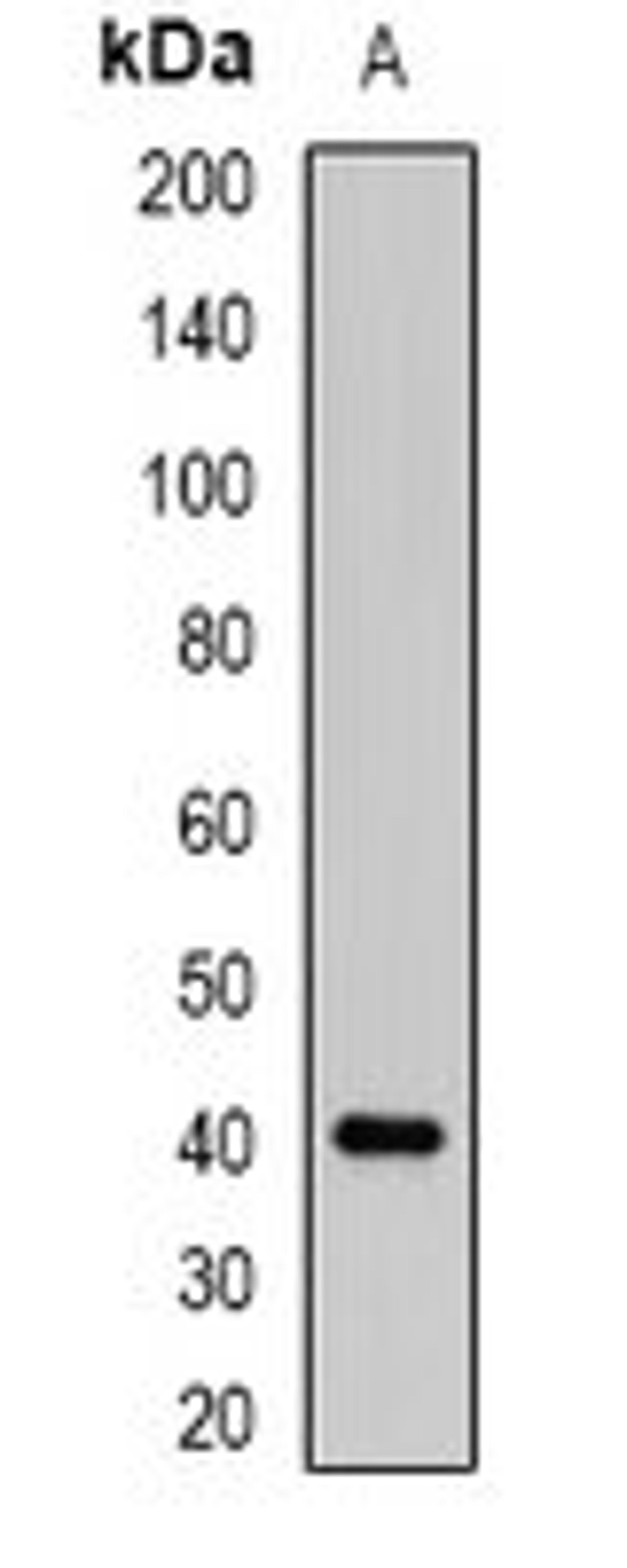 Western blot analysis of K562 (Lane1) whole cell lysates using ABO antibody