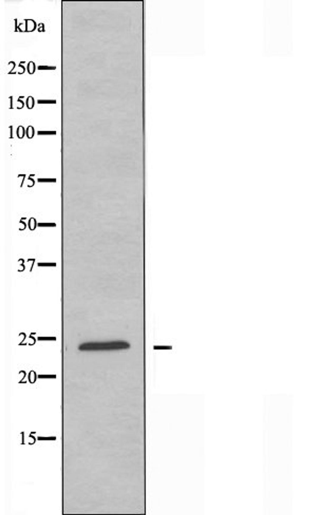 Western blot analysis of Jurkat cells using MDFI antibody