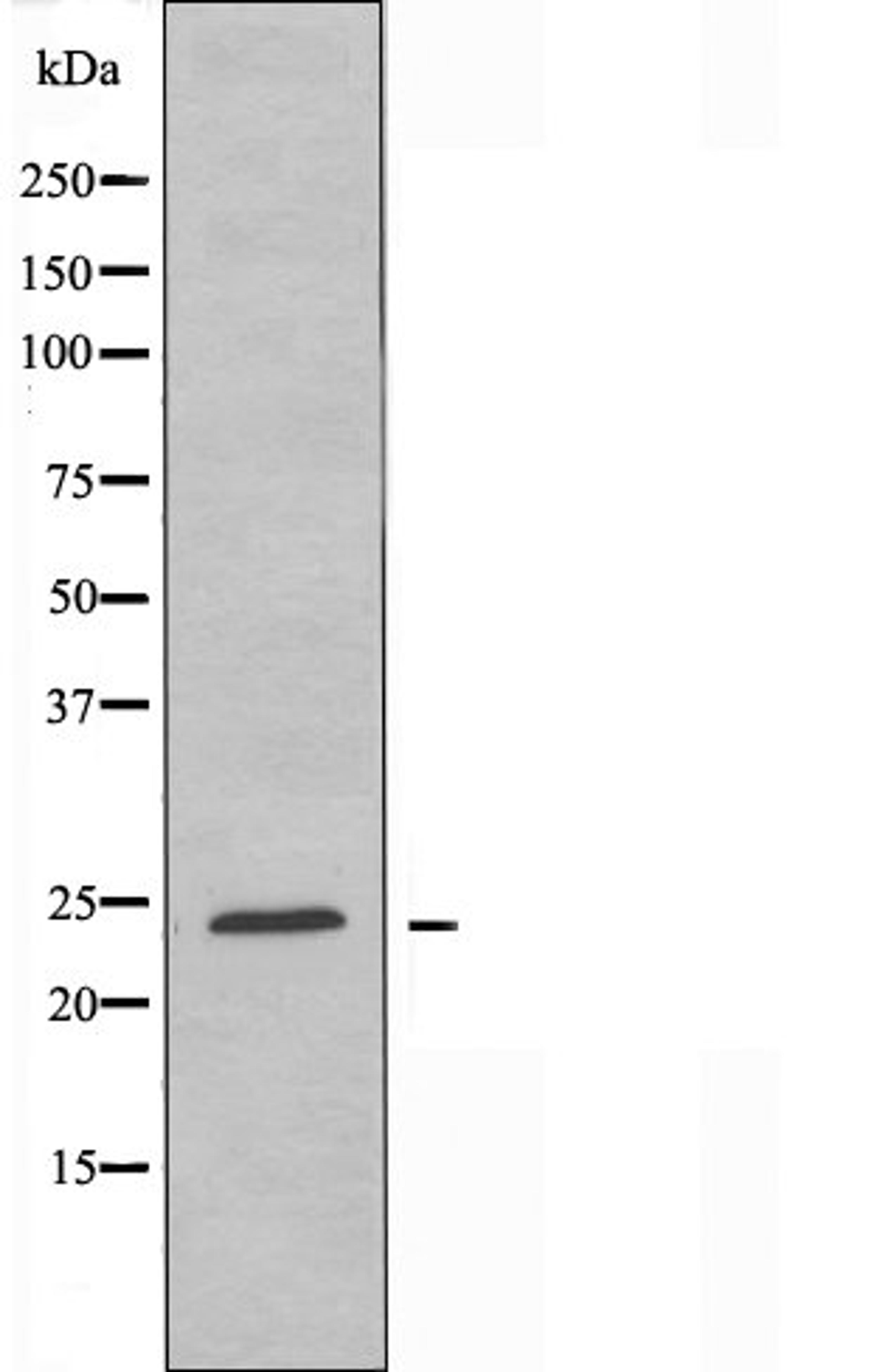 Western blot analysis of Jurkat cells using MDFI antibody