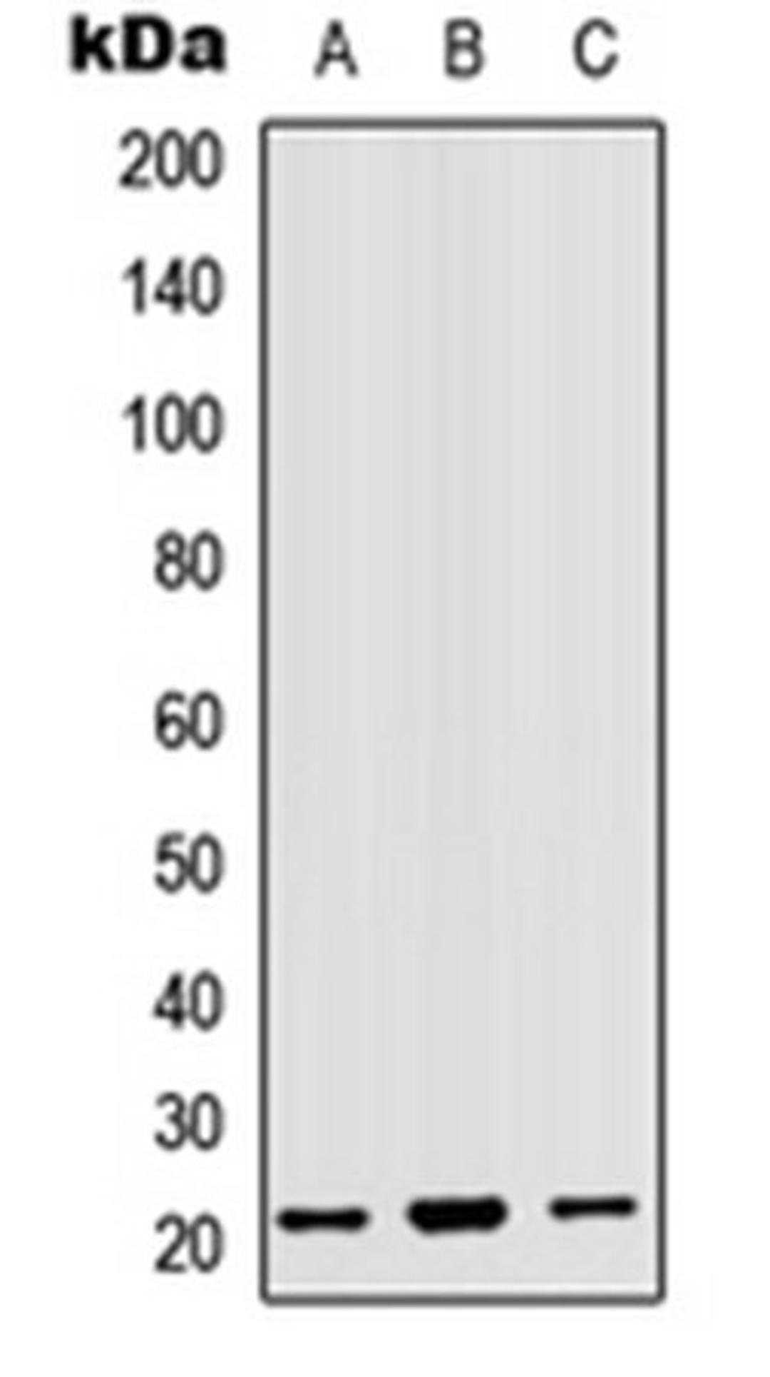 Western blot analysis of HepG2 (Lane 1), HEK293T (Lane 2), Hela (Lane 3) whole cell lysates using MRPL18 antibody