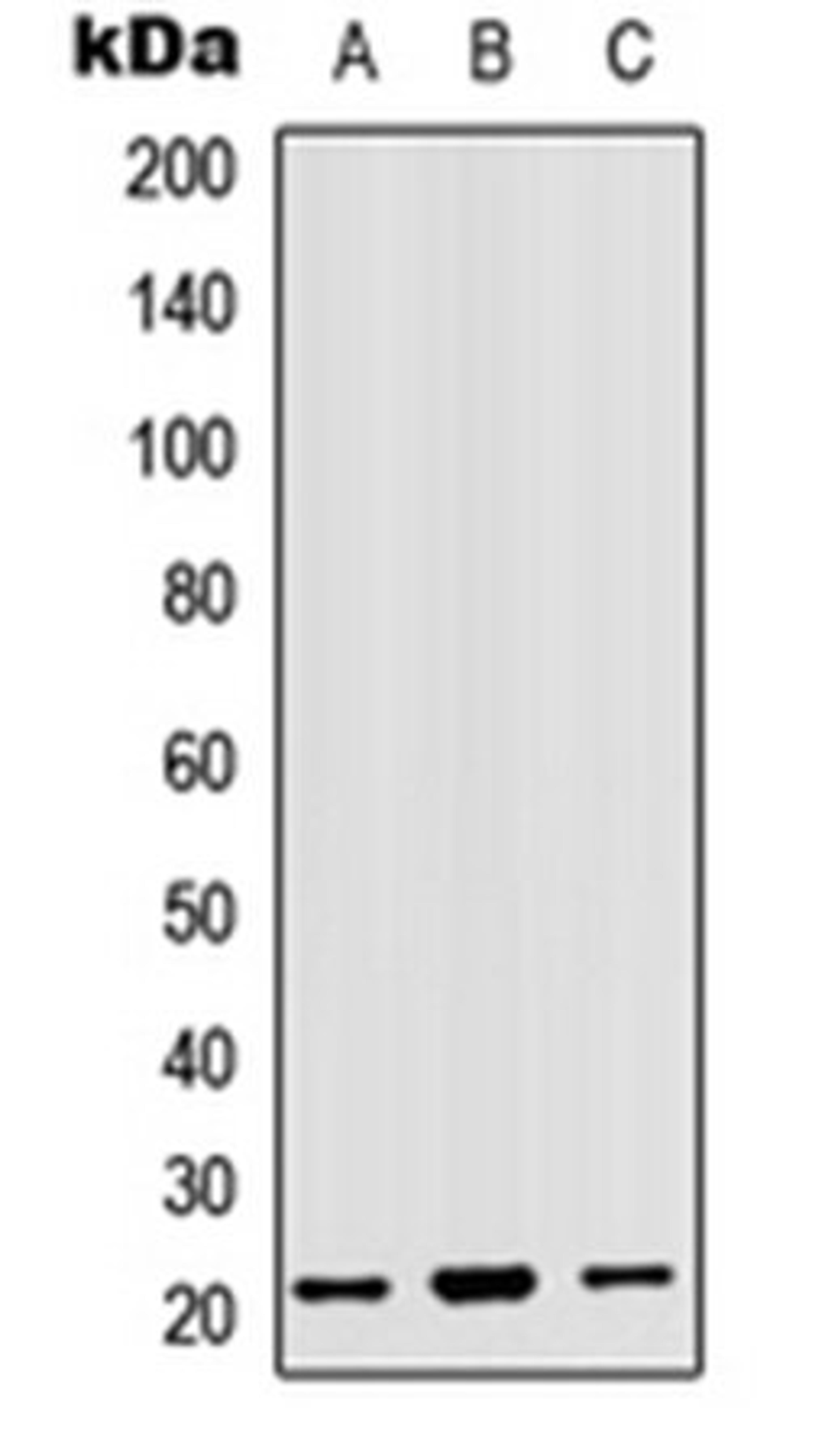 Western blot analysis of HepG2 (Lane 1), HEK293T (Lane 2), Hela (Lane 3) whole cell lysates using MRPL18 antibody