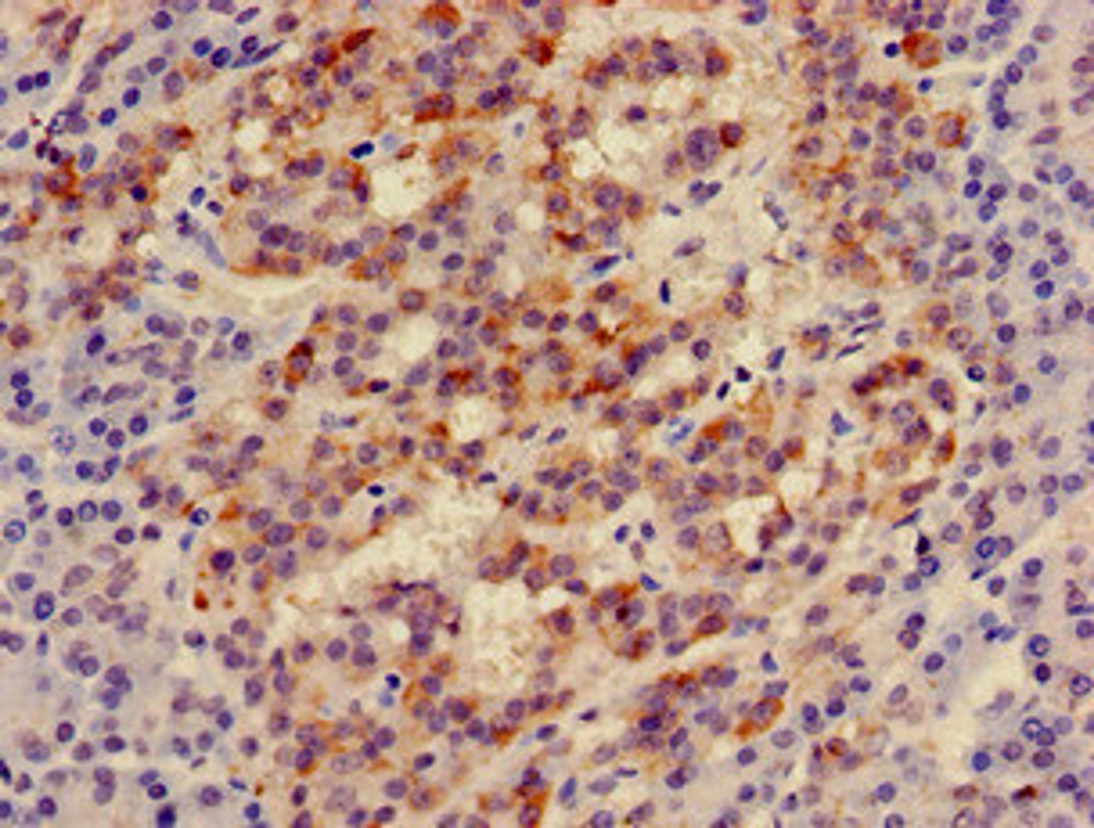 Immunohistochemistry of paraffin-embedded human pancreatic tissue using CSB-PA011830LA01HU at dilution of 1:100