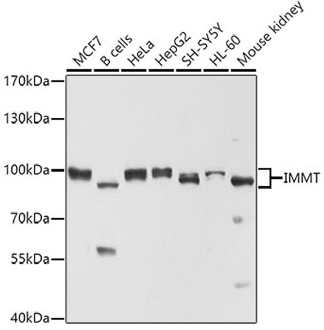 Western blot - IMMT antibody (A2751)