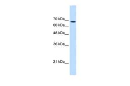 Antibody used in WB on Human HepG2 at 0.2-1 ug/ml.