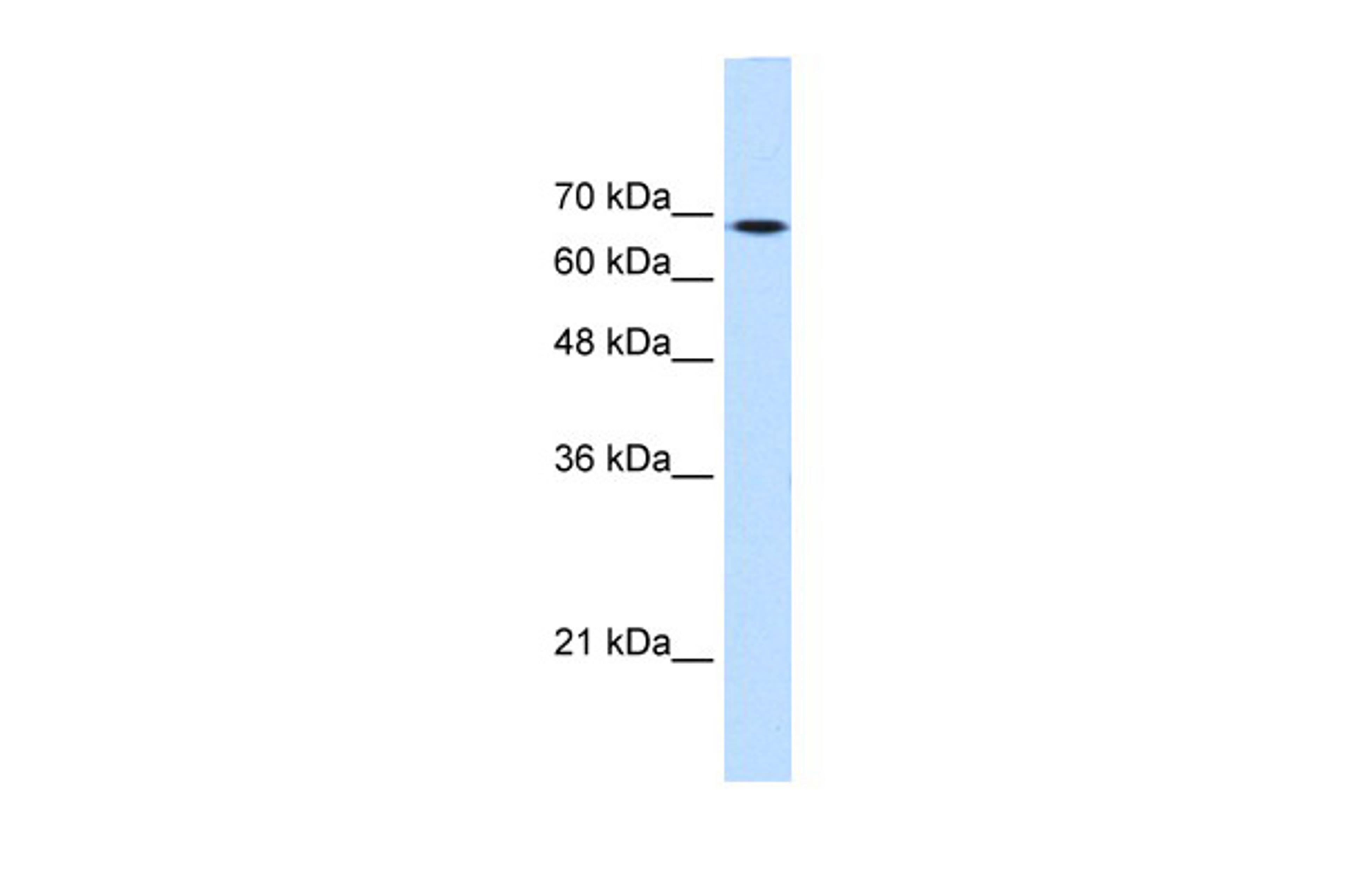 Antibody used in WB on Human HepG2 at 0.2-1 ug/ml.