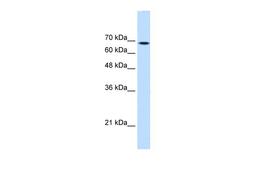 Antibody used in WB on Human HepG2 at 0.2-1 ug/ml.