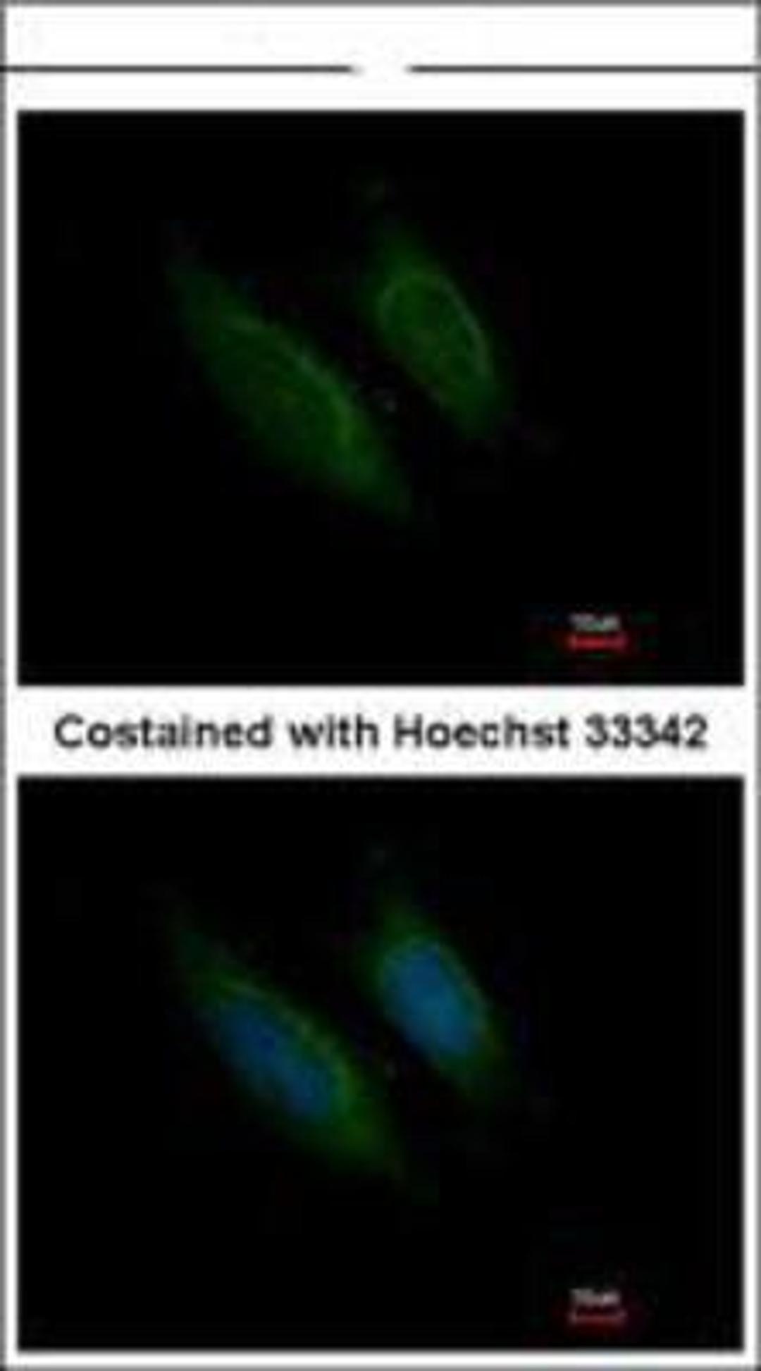 Immunocytochemistry/Immunofluorescence: Coagulation Factor X Antibody [NBP1-33320] -  Methanol-fixed HeLa, using Factor X antibody at 1:200 dilution.