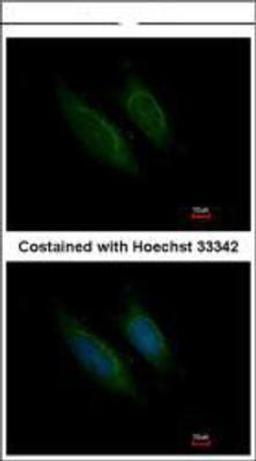 Immunocytochemistry/Immunofluorescence: Coagulation Factor X Antibody [NBP1-33320] -  Methanol-fixed HeLa, using Factor X antibody at 1:200 dilution.