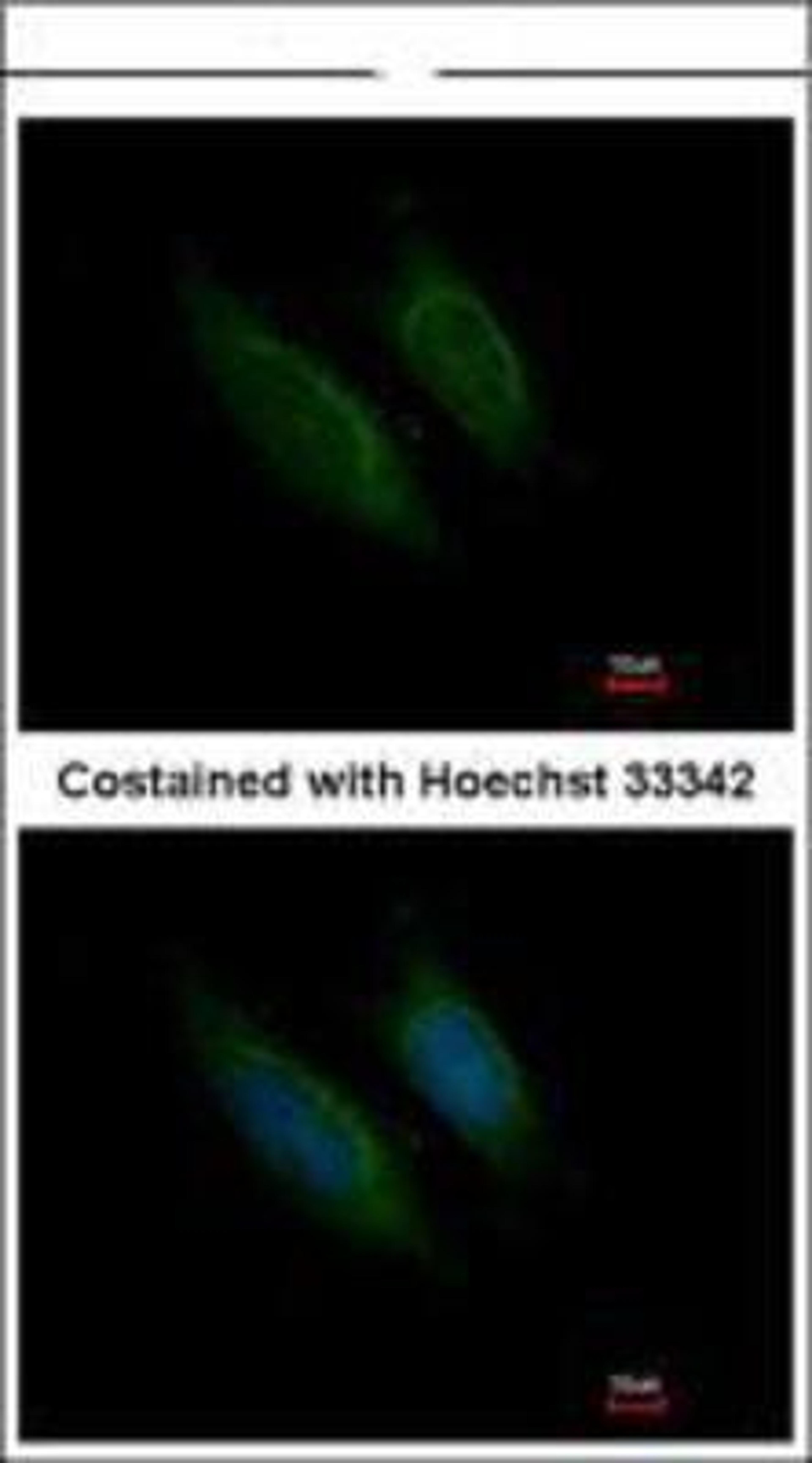 Immunocytochemistry/Immunofluorescence: Coagulation Factor X Antibody [NBP1-33320] -  Methanol-fixed HeLa, using Factor X antibody at 1:200 dilution.