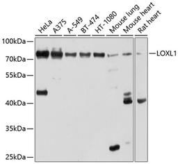 Western blot - LOXL1 antibody (A10191)