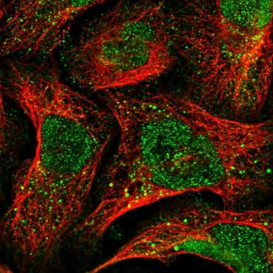 Immunocytochemistry/Immunofluorescence: TMEM174 Antibody [NBP1-82023] - Staining of human cell line U-2 OS shows positivity in nucleus but not nucleoli & vesicles.