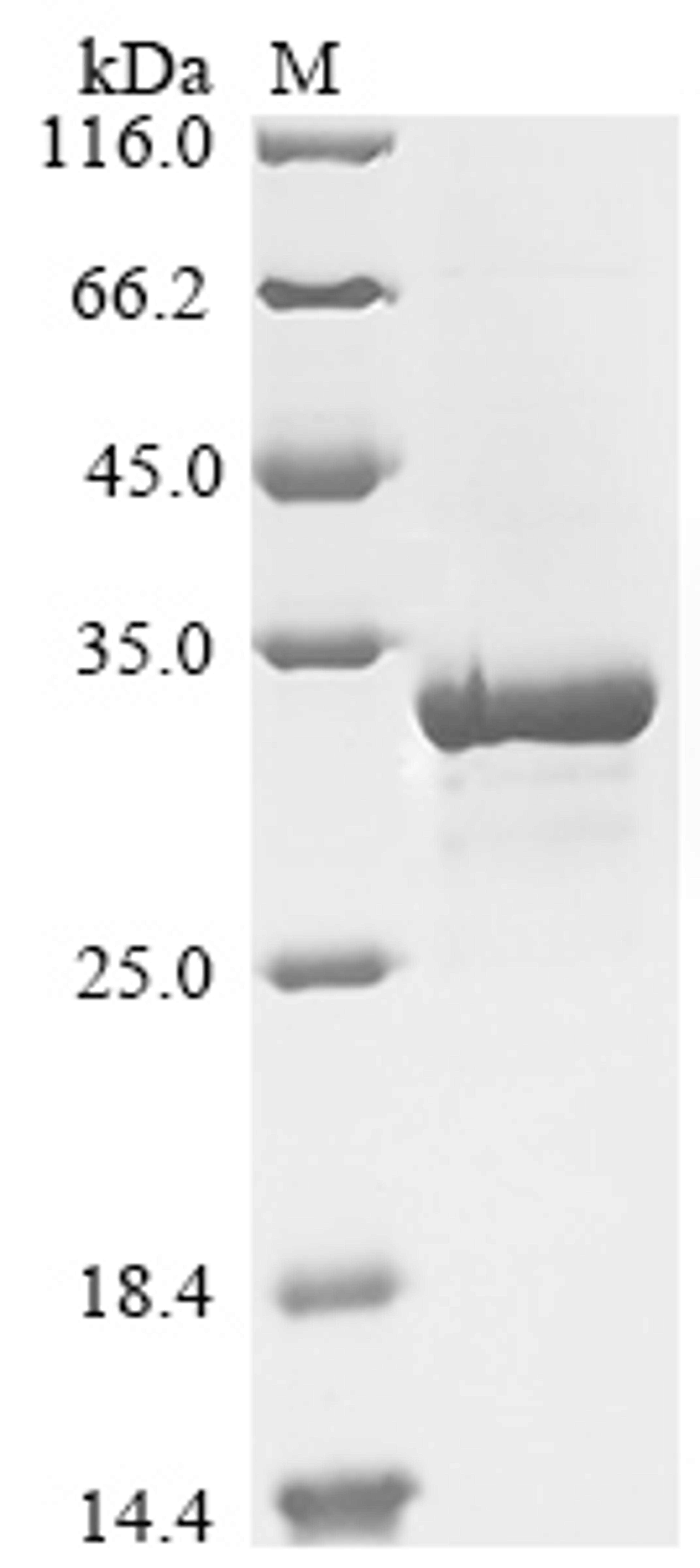 (Tris-Glycine gel) Discontinuous SDS-PAGE (reduced) with 5% enrichment gel and 15% separation gel.