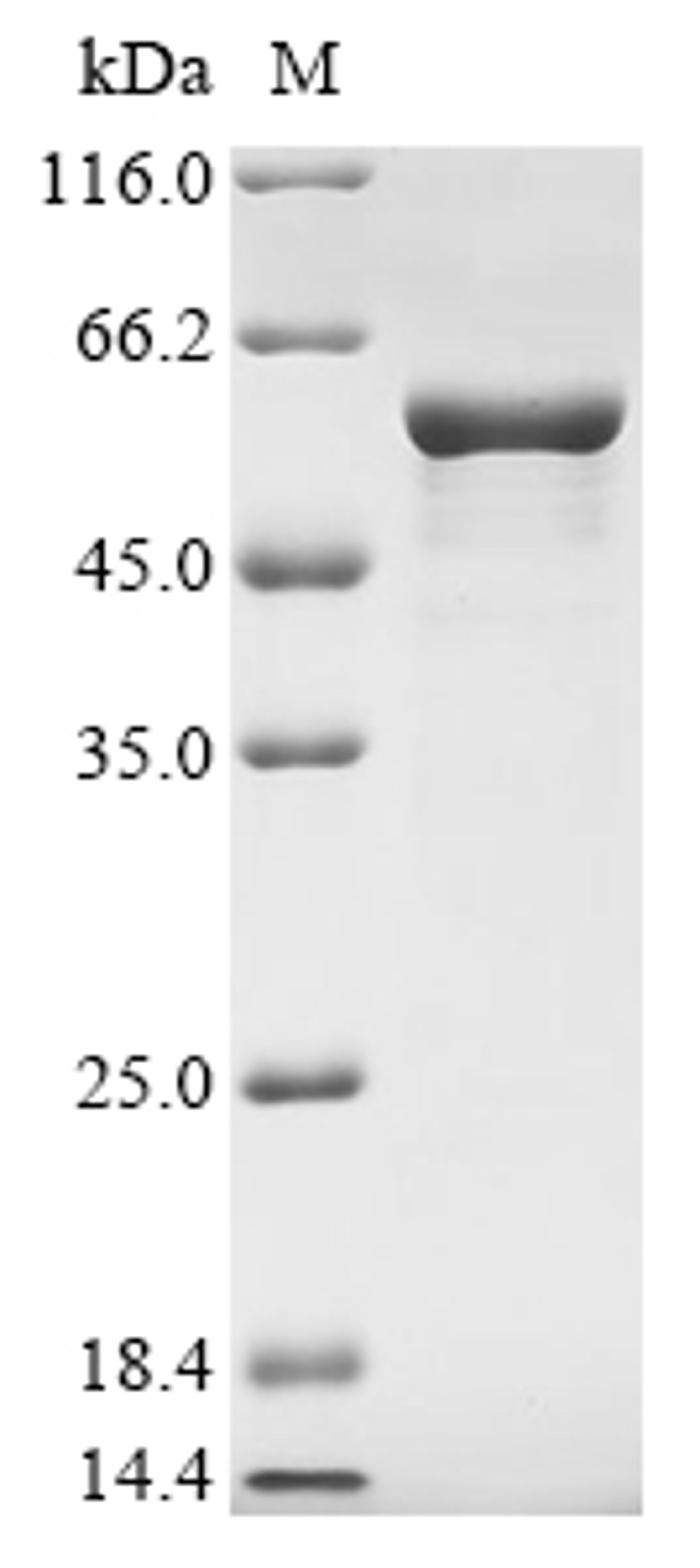 (Tris-Glycine gel) Discontinuous SDS-PAGE (reduced) with 5% enrichment gel and 15% separation gel.
