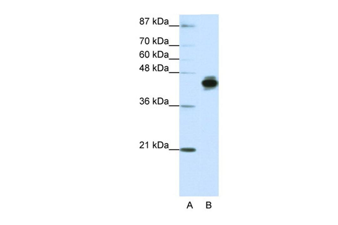 Antibody used in WB on Human HepG2 at 1.25 ug/ml.