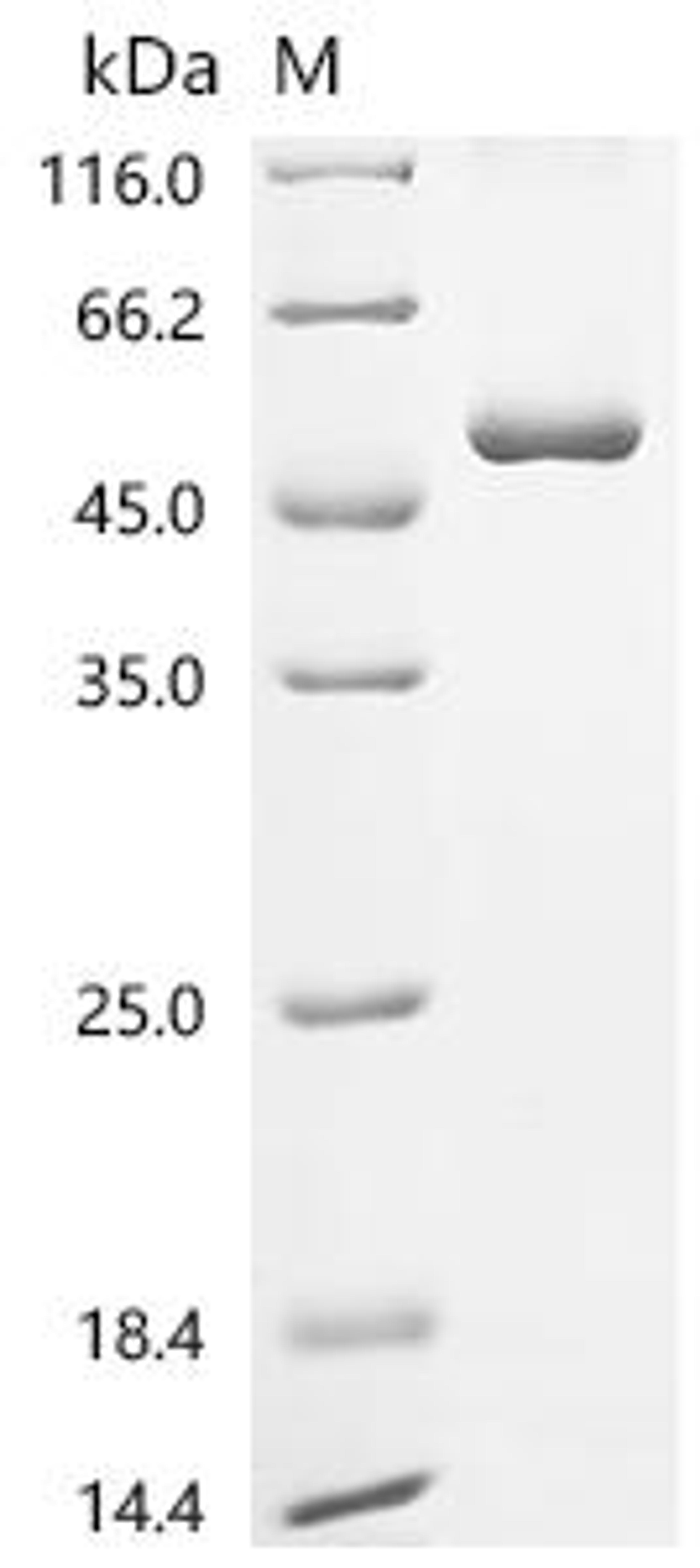 (Tris-Glycine gel) Discontinuous SDS-PAGE (reduced) with 5% enrichment gel and 15% separation gel.