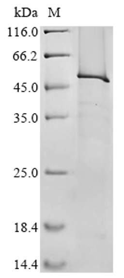 (Tris-Glycine gel) Discontinuous SDS-PAGE (reduced) with 5% enrichment gel and 15% separation gel.