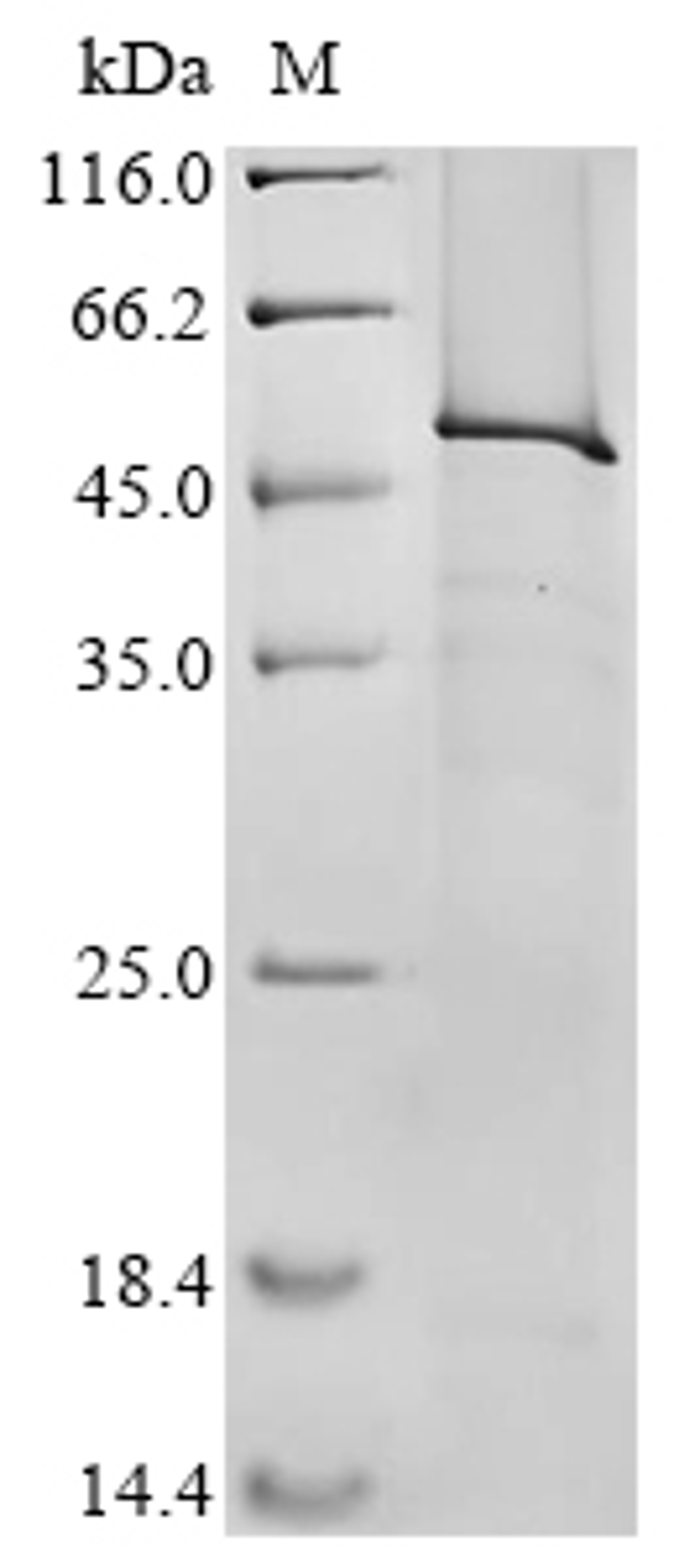 (Tris-Glycine gel) Discontinuous SDS-PAGE (reduced) with 5% enrichment gel and 15% separation gel.