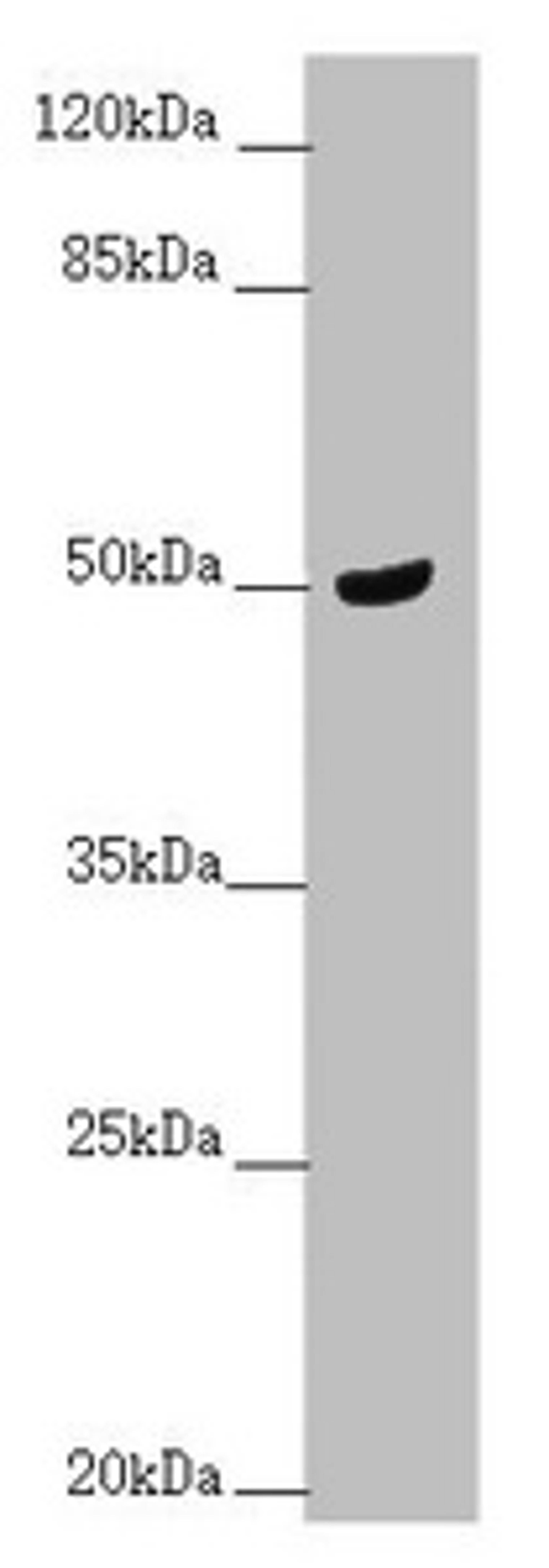 Western blot. All lanes: TAMM41 antibody at 1.68 ug/ml + Mouse brain tissue. Secondary. Goat polyclonal to rabbit IgG at 1/10000 dilution. Predicted band size: 52, 36, 39 kDa. Observed band size: 52 kDa.