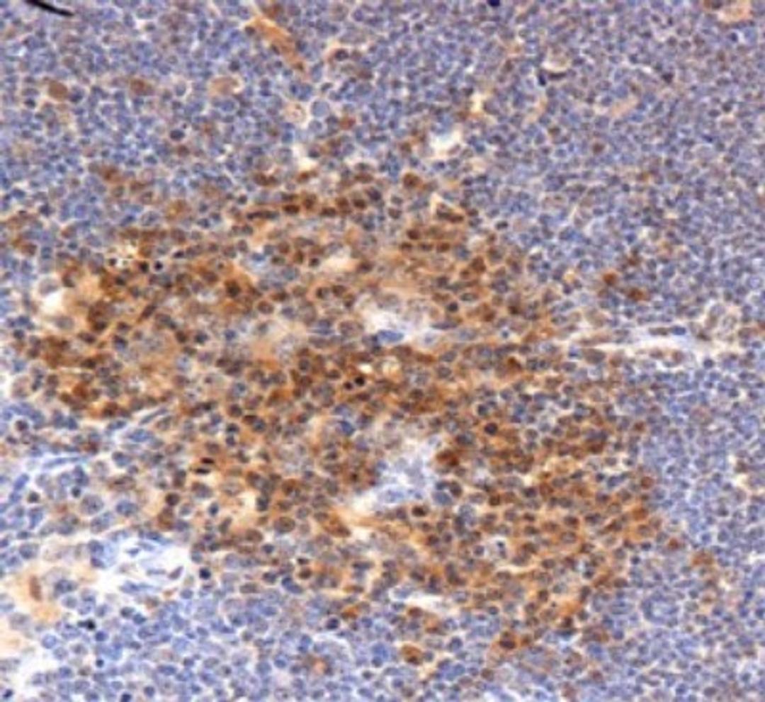 Immunohistochemistry: Profilin 1 Antibody [NBP1-19344] - Staining of Profilin in mouse thymus.