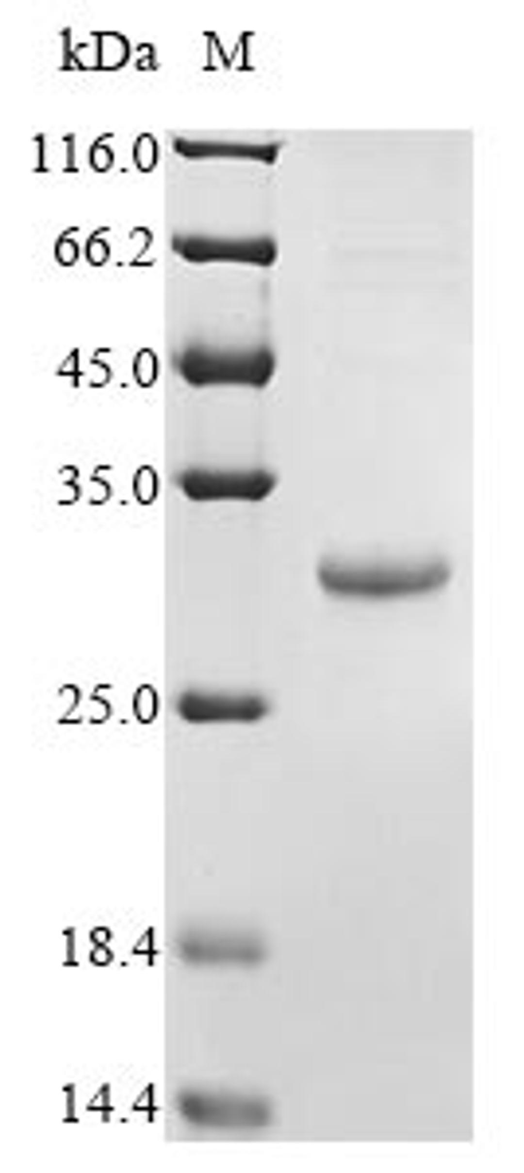 (Tris-Glycine gel) Discontinuous SDS-PAGE (reduced) with 5% enrichment gel and 15% separation gel.