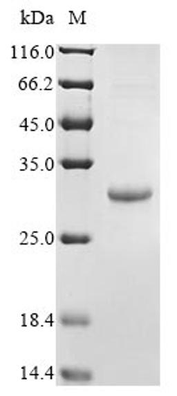 (Tris-Glycine gel) Discontinuous SDS-PAGE (reduced) with 5% enrichment gel and 15% separation gel.