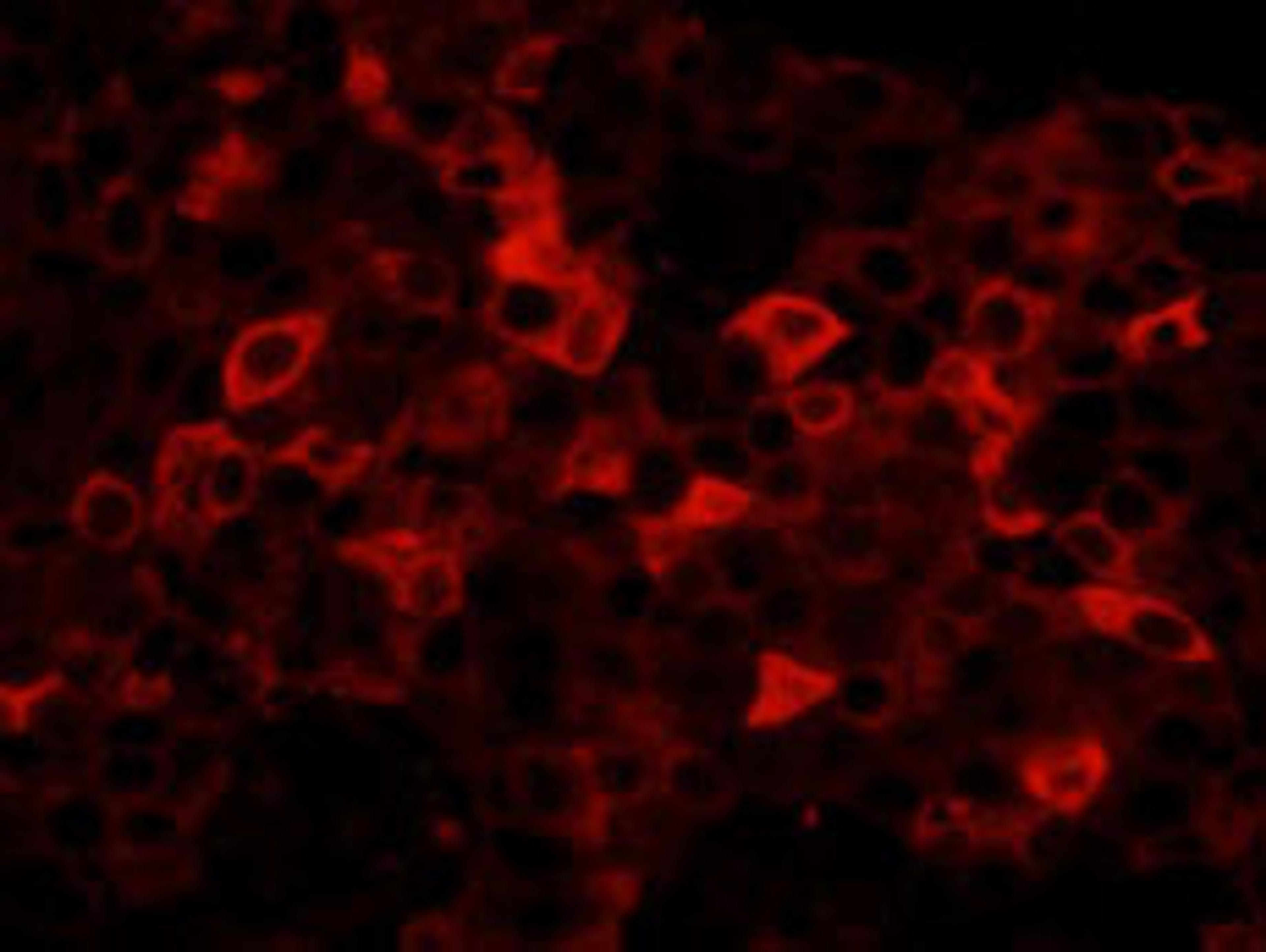 Detection of human FASN by IHC-IF.