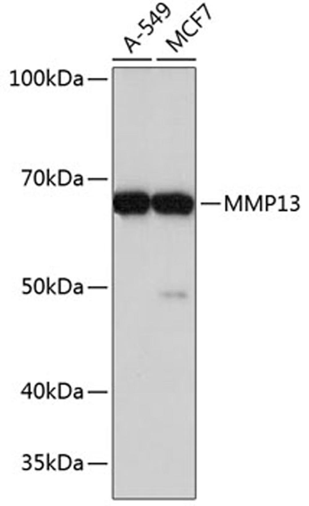 Western blot - MMP13 Rabbit mAb (A11148)