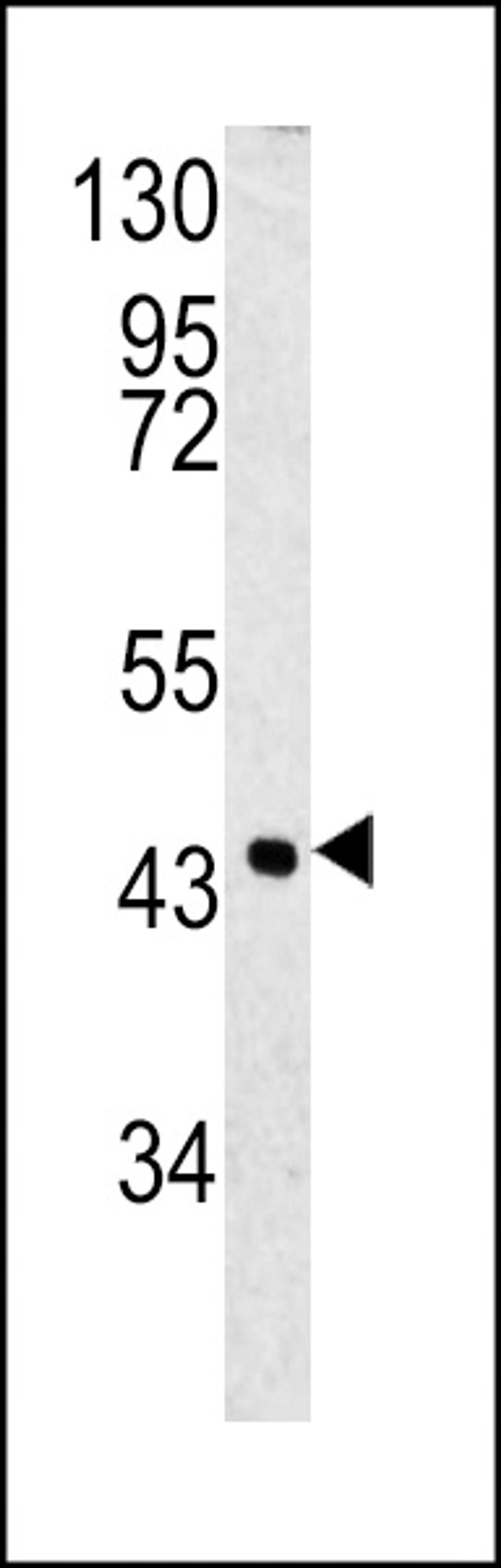 Western blot analysis of SPB3 antibody in 293 cell line lysates (35ug/lane)