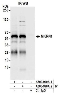 Detection of human MKRN1 by western blot of immunoprecipitates.