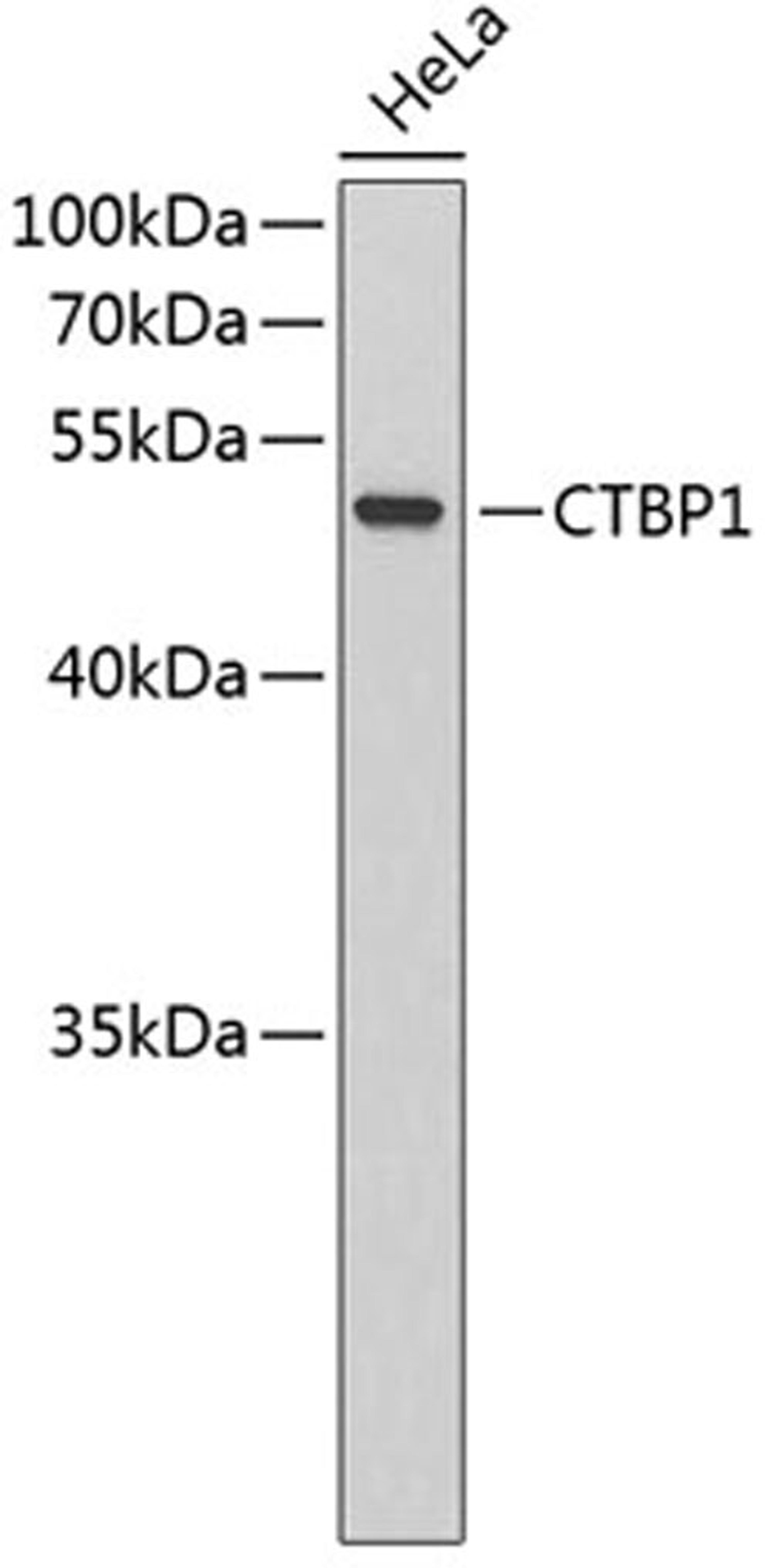 Western blot - CTBP1 antibody (A3257)