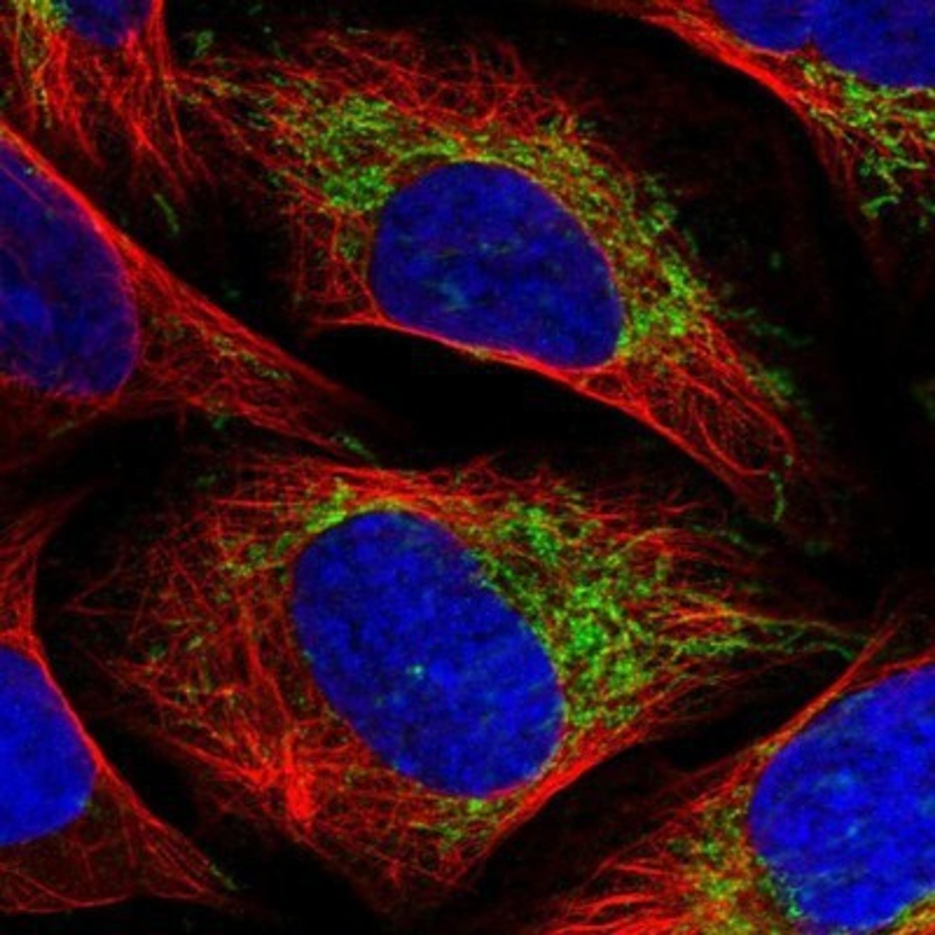 Immunocytochemistry/Immunofluorescence: TIMM10 Antibody [NBP1-80682] - Staining of human cell line U-2 OS shows positivity in mitochondria.