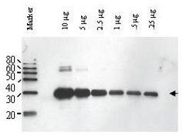 Western blot analysis of ULP-1 fusion protein (arrowhead) using ULP1 antibody