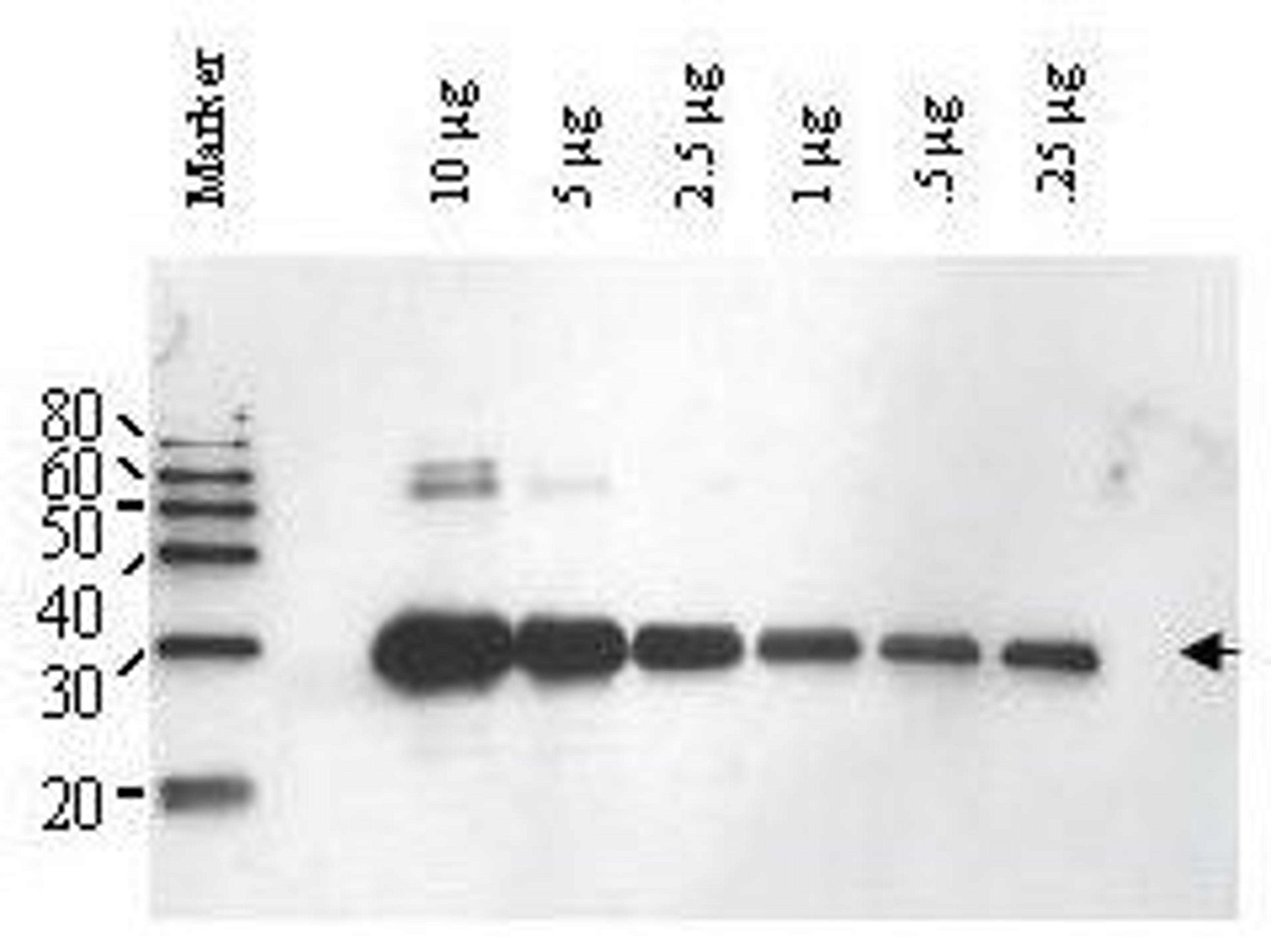 Western blot analysis of ULP-1 fusion protein (arrowhead) using ULP1 antibody