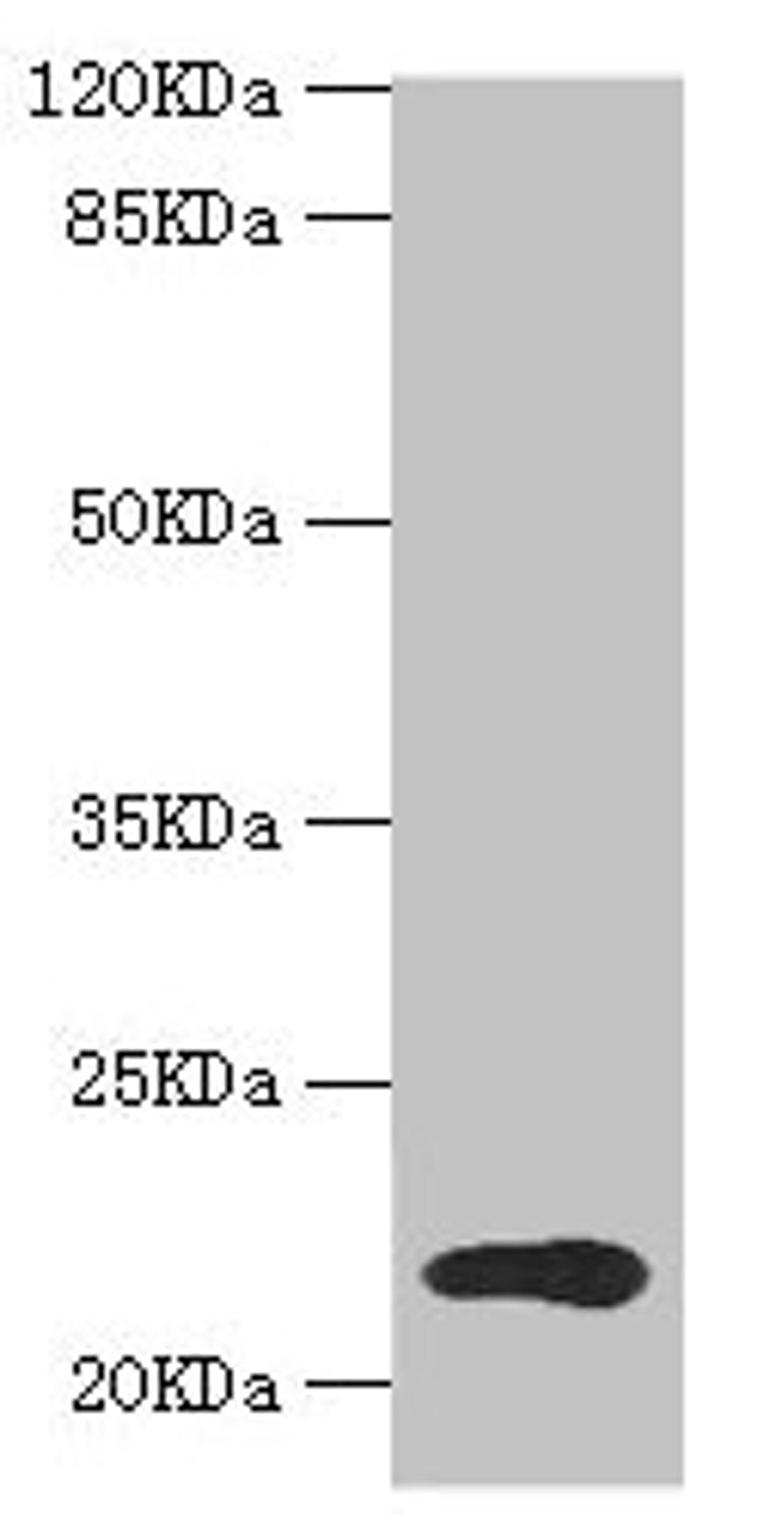 Western blot. All lanes: TPD52L1 antibody at 1.31µg/ml + MCF-7 whole cell lysate. Secondary. Goat polyclonal to rabbit IgG at 1/10000 dilution. Predicted band size: 23, 17, 15, 12, 20 kDa. Observed band size: 23 kDa