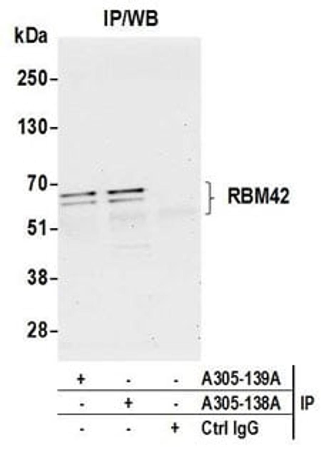 Detection of human RBM42 by western blot of immunoprecipitates.