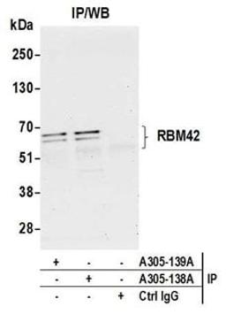 Detection of human RBM42 by western blot of immunoprecipitates.