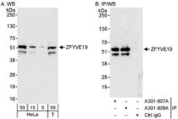 Detection of human ZFYVE19 by western blot and immunoprecipitation.