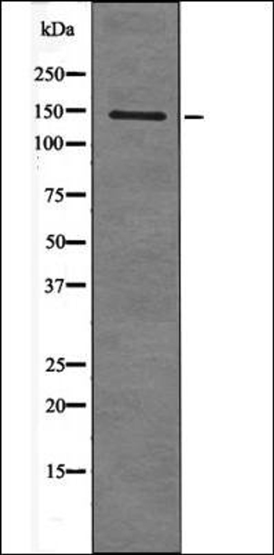 Western blot analysis of EGF treated HepG2 whole cell lysates using KIT -Phospho-Tyr568- antibody