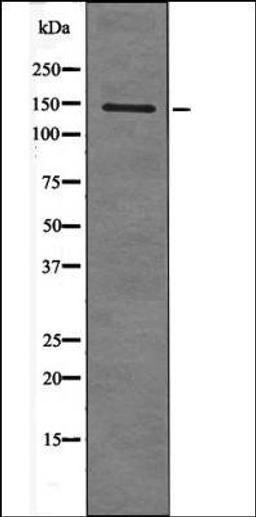 Western blot analysis of EGF treated HepG2 whole cell lysates using KIT -Phospho-Tyr568- antibody