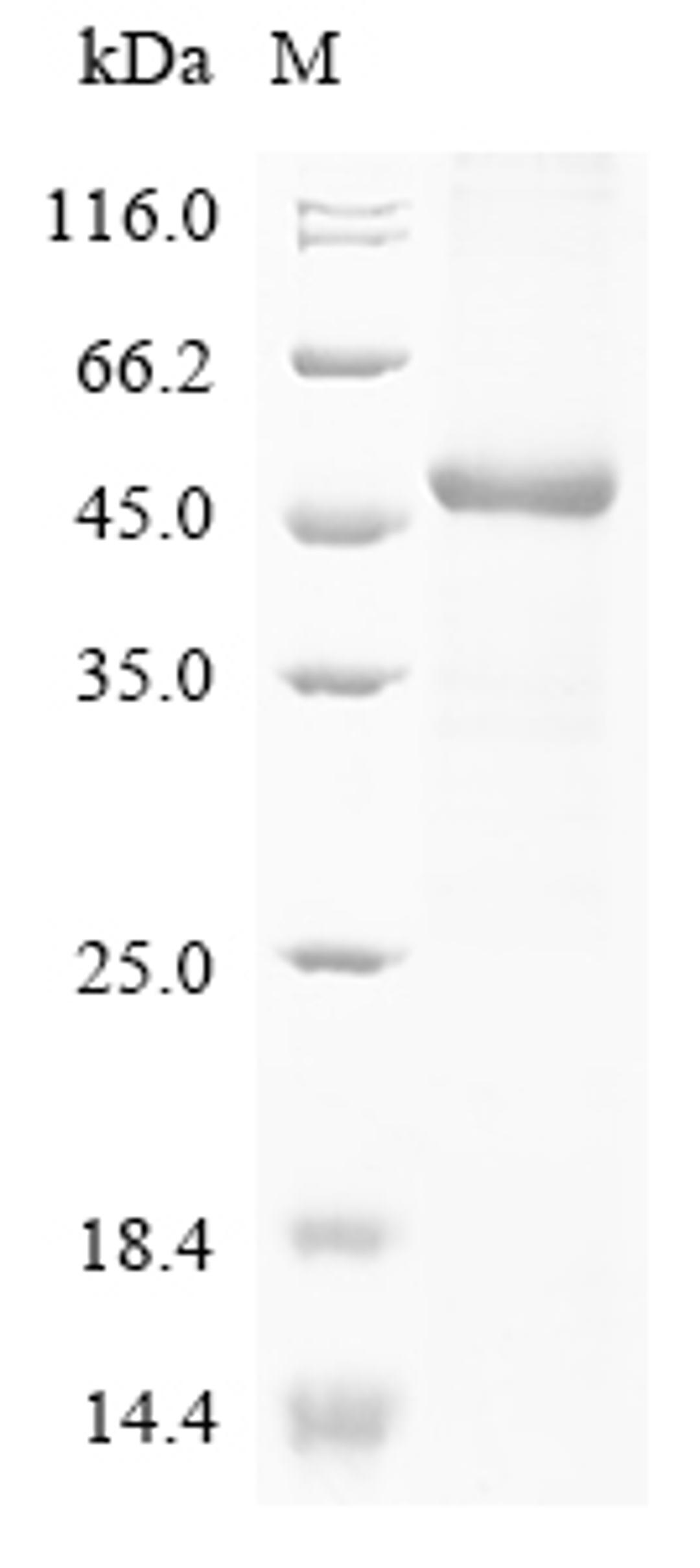 (Tris-Glycine gel) Discontinuous SDS-PAGE (reduced) with 5% enrichment gel and 15% separation gel.