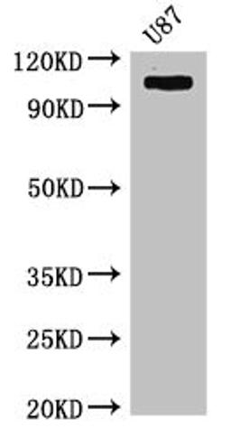 Western Blot. Positive WB detected in: U87 whole cell lysate. All lanes: HK2 antibody at 4µg/ml. Secondary. Goat polyclonal to rabbit IgG at 1/50000 dilution. Predicted band size: 103 kDa. Observed band size: 103 kDa