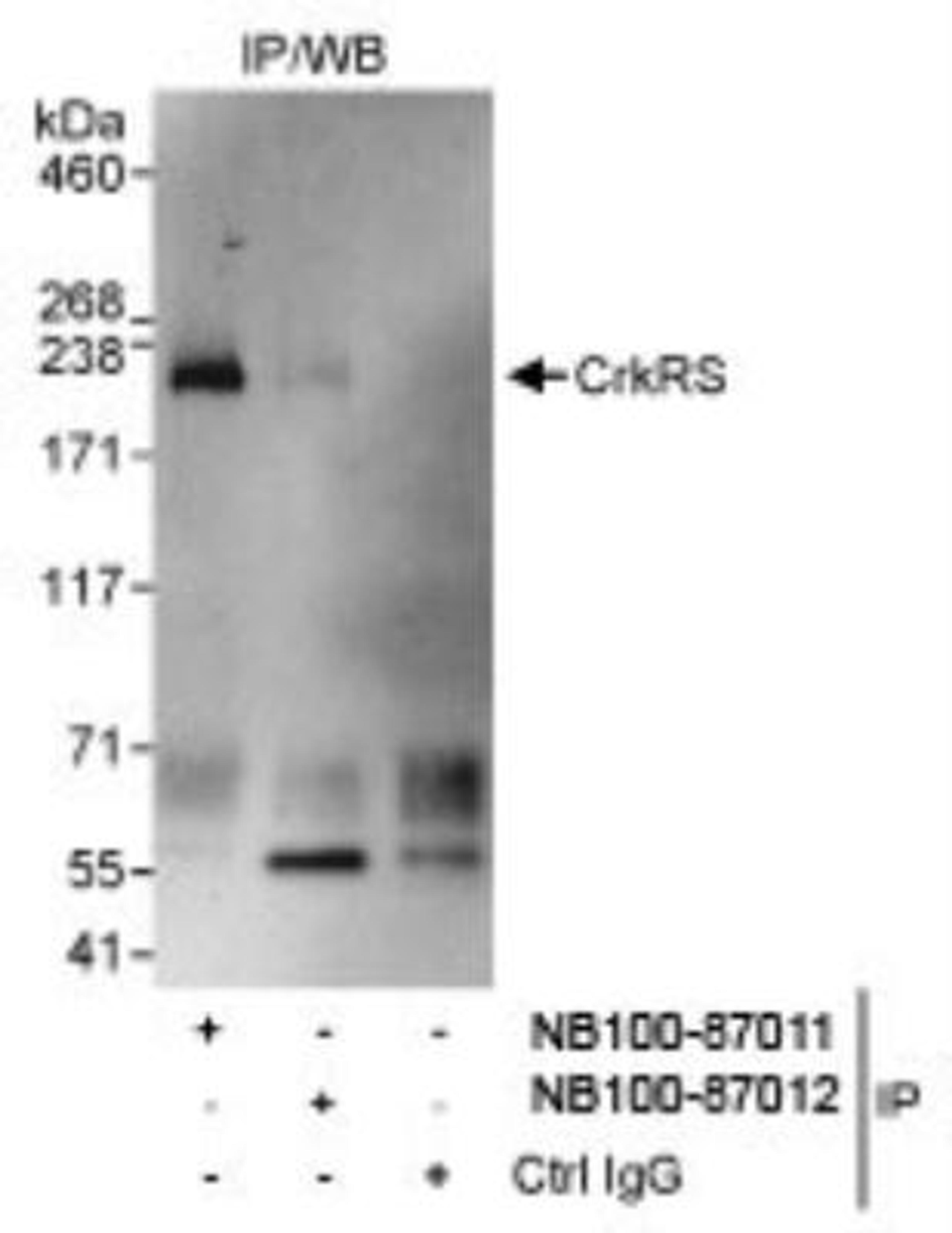 Immunoprecipitation: CrkRS Antibody [NB100-87011] - Detection of Human CrkRS by Western Blot of  Immunoprecipitates. Samples: Whole cell lysate (1 mg for IP,  20% of IP loaded) from HeLa cells. Antibodies: Affinity purified  rabbit anti-CrkRS antibody NB100-87011 used for IP at 3 mcg/mg  lysate. NB100-87012 was used at 1 mcg/ml,