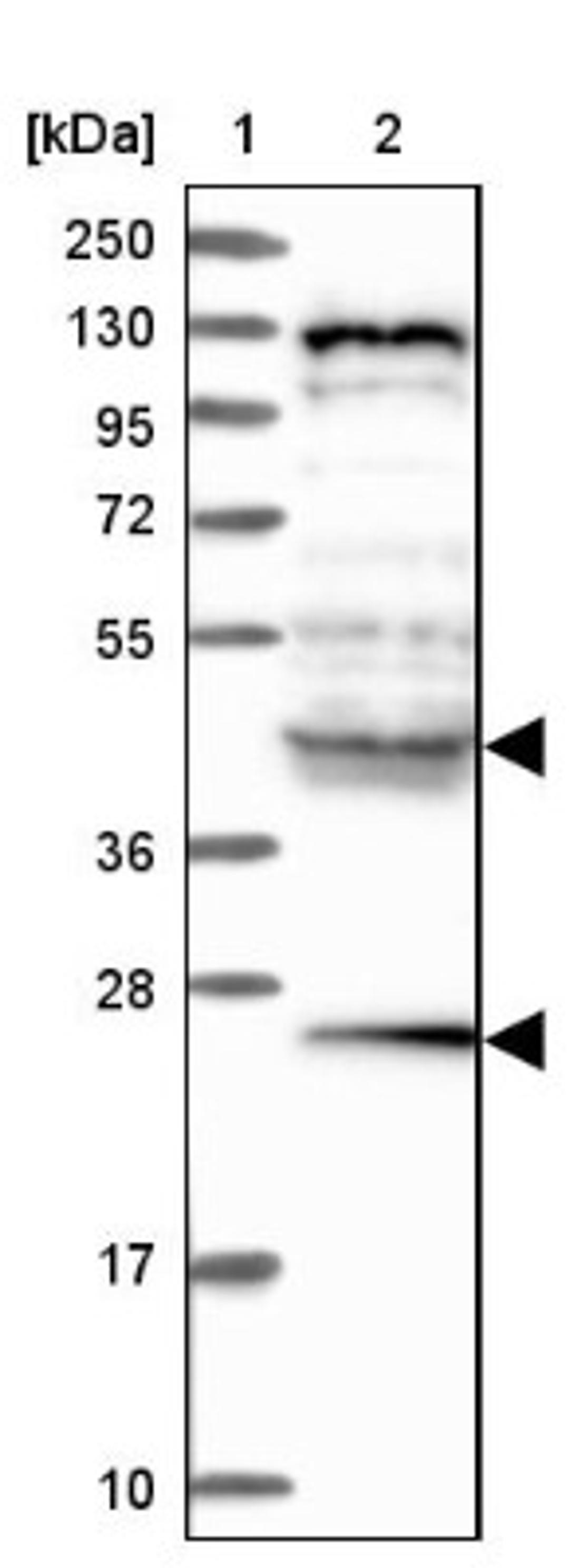 Western Blot: HYI Antibody [NBP1-81659] - Lane 1: Marker [kDa] 250, 130, 95, 72, 55, 36, 28, 17, 10<br/>Lane 2: Human cell line RT-4